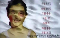 家族群伤痕照片背后：少年被虐致死悲剧